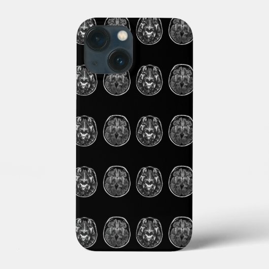 Brain Mri Scan Case-Mate iPhone Hülle (Rückseite)