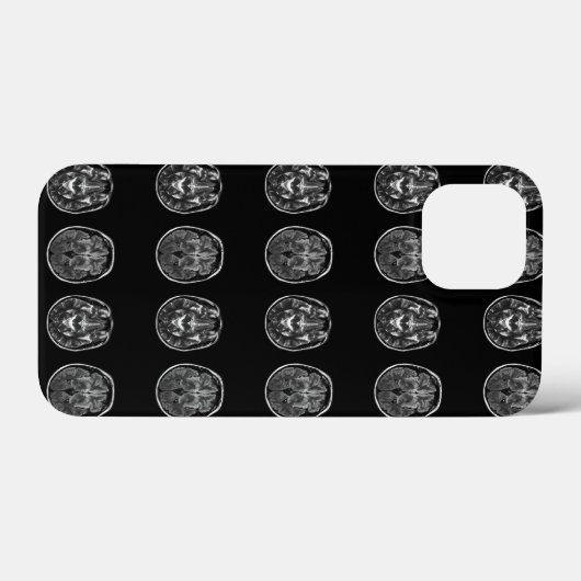 Brain Mri Scan Case-Mate iPhone Hülle (Rückseite (Horizontal))