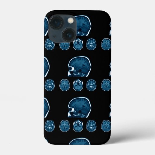 Brain Mri scan Case-Mate iPhone Hülle (Rückseite)