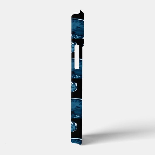 Brain Mri scan Case-Mate iPhone Hülle (Rückseite / Rechts)