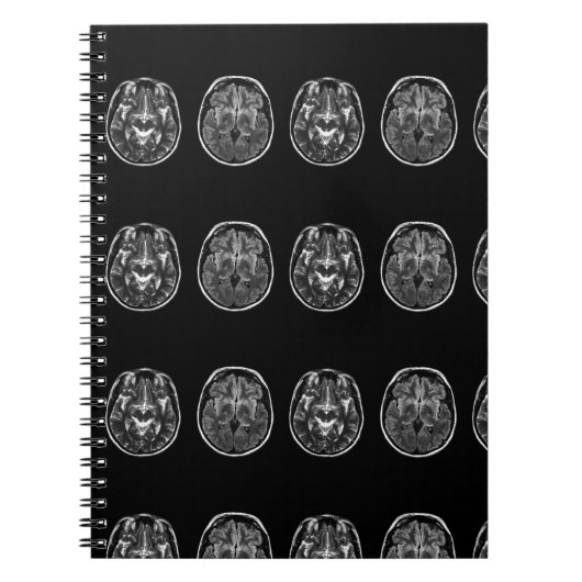 Brain Mri Scan Notizblock (Vorderseite)