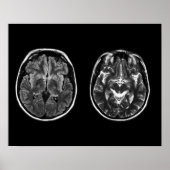 Brain Mri Scan Poster (Vorne)