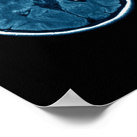 Brain Mri scan Poster (Ecke)