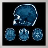 Brain Mri scan Poster (Vorne)