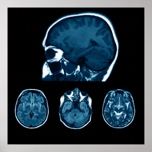 Brain Mri scan Poster (Vorne)