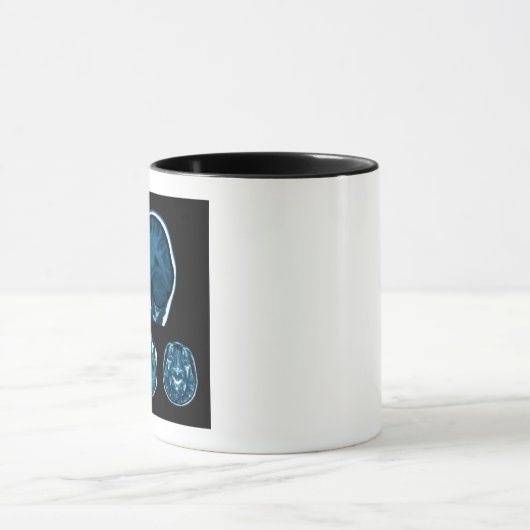 Brain Mri scan Tasse (Zentrum)