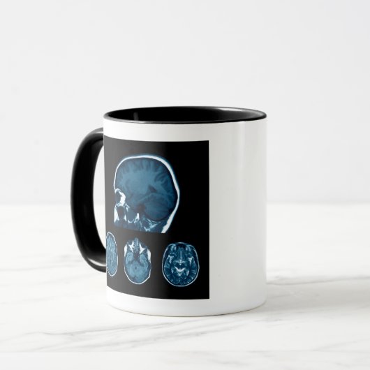 Brain Mri scan Tasse (Vorderseite Links)