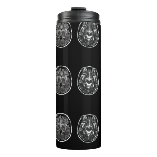 Brain Mri Scan Thermosbecher (Vorderseite)