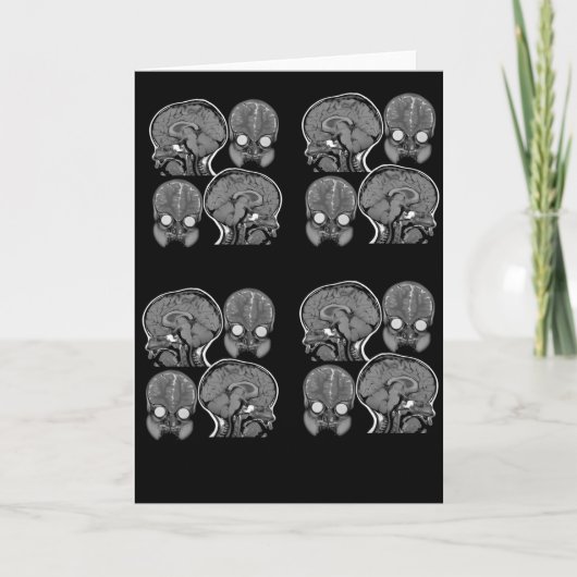 BRAINS! (MRI) KARTE (Vorderseite)