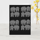 BRAINS! (MRI) KARTE (Gelbe Blume)