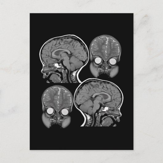 BRAINS! (MRI) POSTKARTE (Vorderseite)