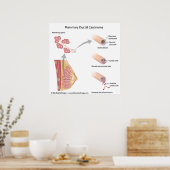 Brustkrebs Darmkrebs, beschriftet. Poster (Küche)