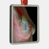 Brustkrebs Ornament Aus Metall (Rechts)