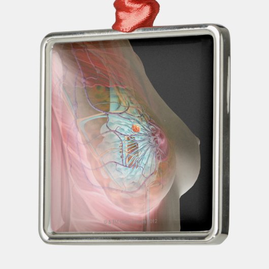 Brustkrebs Ornament Aus Metall (Links)