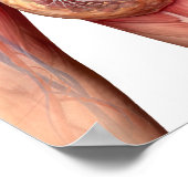 Brustkrebs Poster (Ecke)