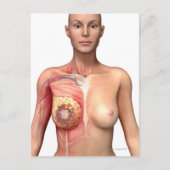 Brustkrebs Postkarte (Vorderseite)