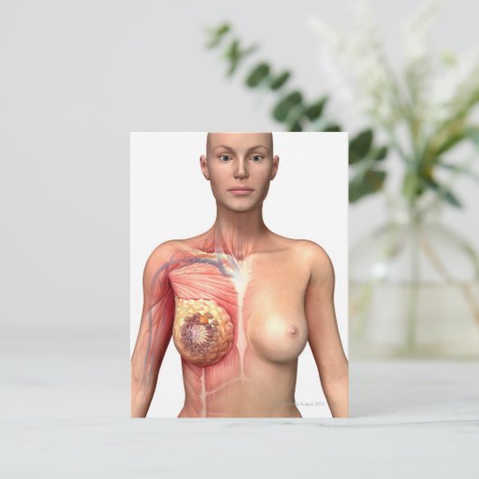 Brustkrebs Postkarte (Stehend Vorderseite)