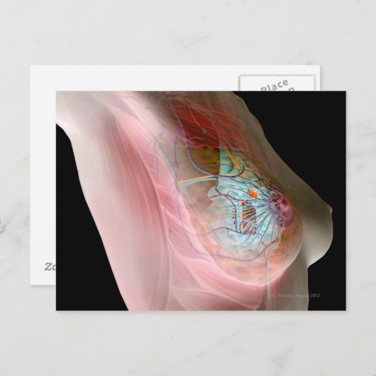 Brustkrebs Postkarte (Vorne/Hinten)