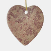 Brustkrebs unter dem Mikroskop Keramikornament (Rechts)