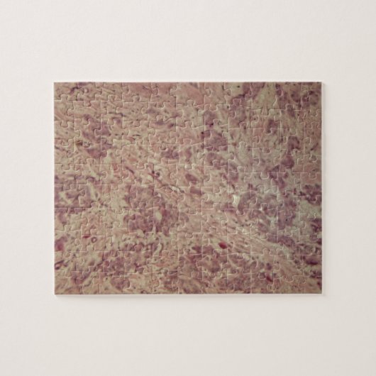 Brustkrebs unter dem Mikroskop Puzzle (Horizontal)