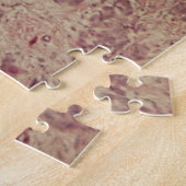 Brustkrebs unter dem Mikroskop Puzzle (Seite)