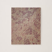 Brustkrebs unter dem Mikroskop Puzzle (Vertikal)