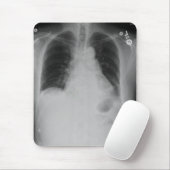 Brustradiographie ~ mousepad (Mit Mouse)