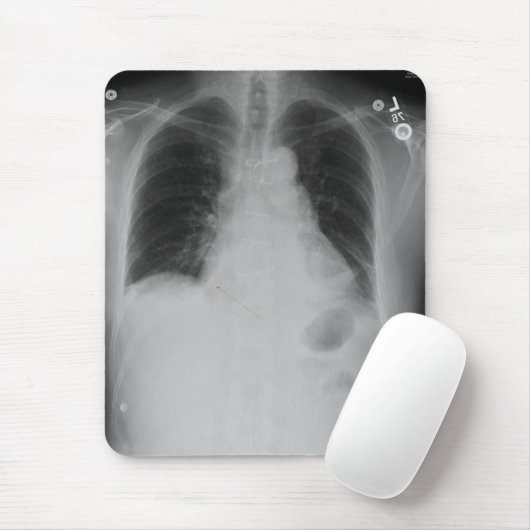 Brustradiographie ~ mousepad (Mit Mouse)