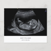 Budget Baby Shower Sonogram Foto Einladung Flyer (Hinten)