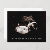 Budget Pregnancy Baby Sonogram Ultrasound Foto (Vorne/Hinten)