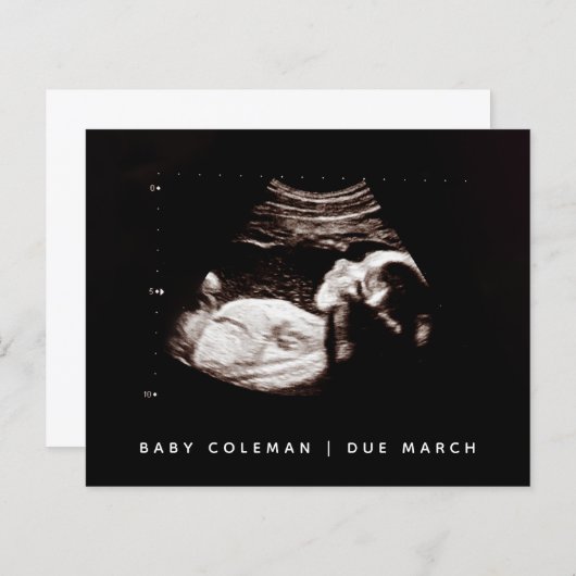 Budget Pregnancy Baby Sonogram Ultrasound Foto (Vorne/Hinten)