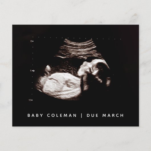 Budget Pregnancy Baby Sonogram Ultrasound Foto Flyer (Vorne)
