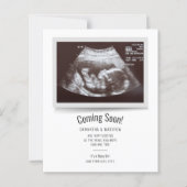 Budget Ultrasound Foto Schwangerschaft Ankündigung (Vorderseite)