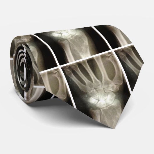 Carpals-Röntgenstrahl-Krawatte Krawatte (Gerollt)