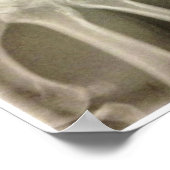 Carpals Xray Poster (Ecke)