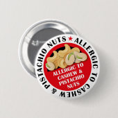 Cashew & Pistachio Nut Allergie Abzeichen Button (Vorne & Hinten)