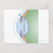 Cataract-Operation Postkarte (Vorderseite)