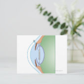 Cataract-Operation Postkarte (Stehend Vorderseite)