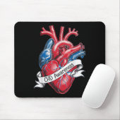 Chd Awareness Anatomisches Herz Band Design Mousepad (Mit Mouse)