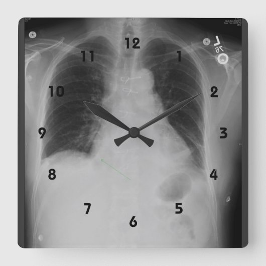 Chest X Ray ~ Clock Quadratische Wanduhr (Vorderseite)