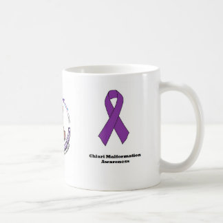 Chiari Missbildungs-Bewusstseins-Tasse Kaffeetasse