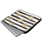 Chic Gold Glitzer Lippen und Streifen Monogramm Laptopschutzhülle (Vorne Knopf)