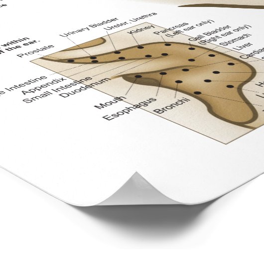 Chinesisches System der Aurikulären Ohrakupunktur Poster (Ecke)