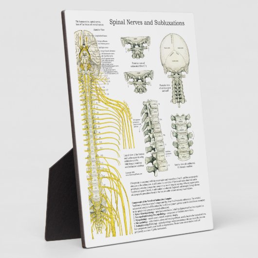 Chiropractic Spinal Nerves Subluxations Easel Fotoplatte (Seite)