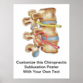 Chiropractic Subluxation Poster individuell gestal (Vorne)