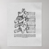 Chiropractic Subluxation Vintag Print Poster (Vorne)