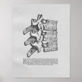 Chiropractic Subluxation Vintag Print Poster (Vorne)