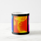 Chiropraktik-Kaffeetasse, Reise-Tassen und Steins Kaffeetasse (Mittel)