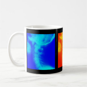 Chiropraktik-Kaffeetasse, Reise-Tassen und Steins Kaffeetasse