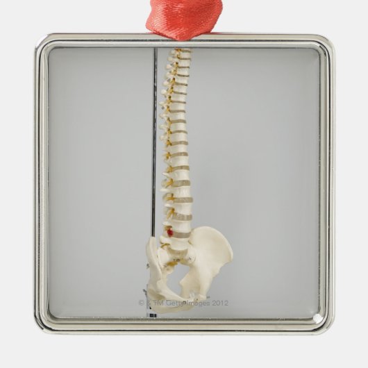 Chiropraktikskelett Silbernes Ornament (Vorne)